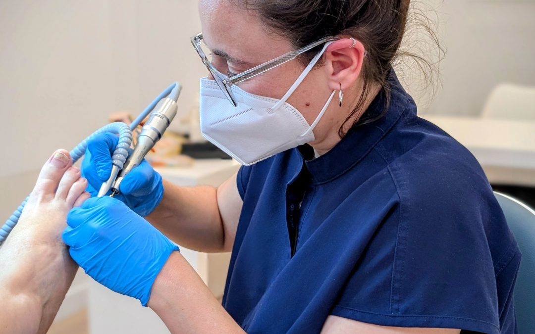 Papil·loma plantar: com saber si és una berruga o una duresa?