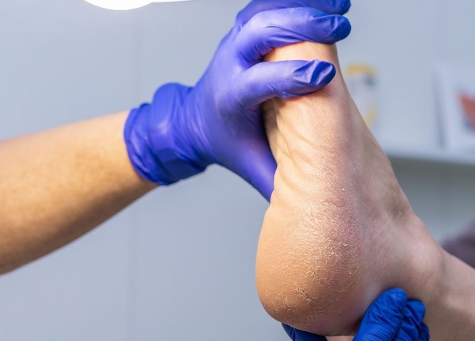 Operació Sandàlies: 5 claus per preparar els teus peus per a l’estiu